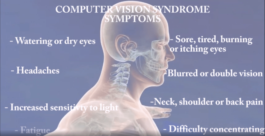 Computer Vision Syndrome infographic