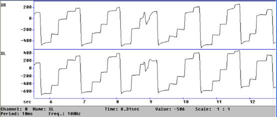 Dual trace eye track graph